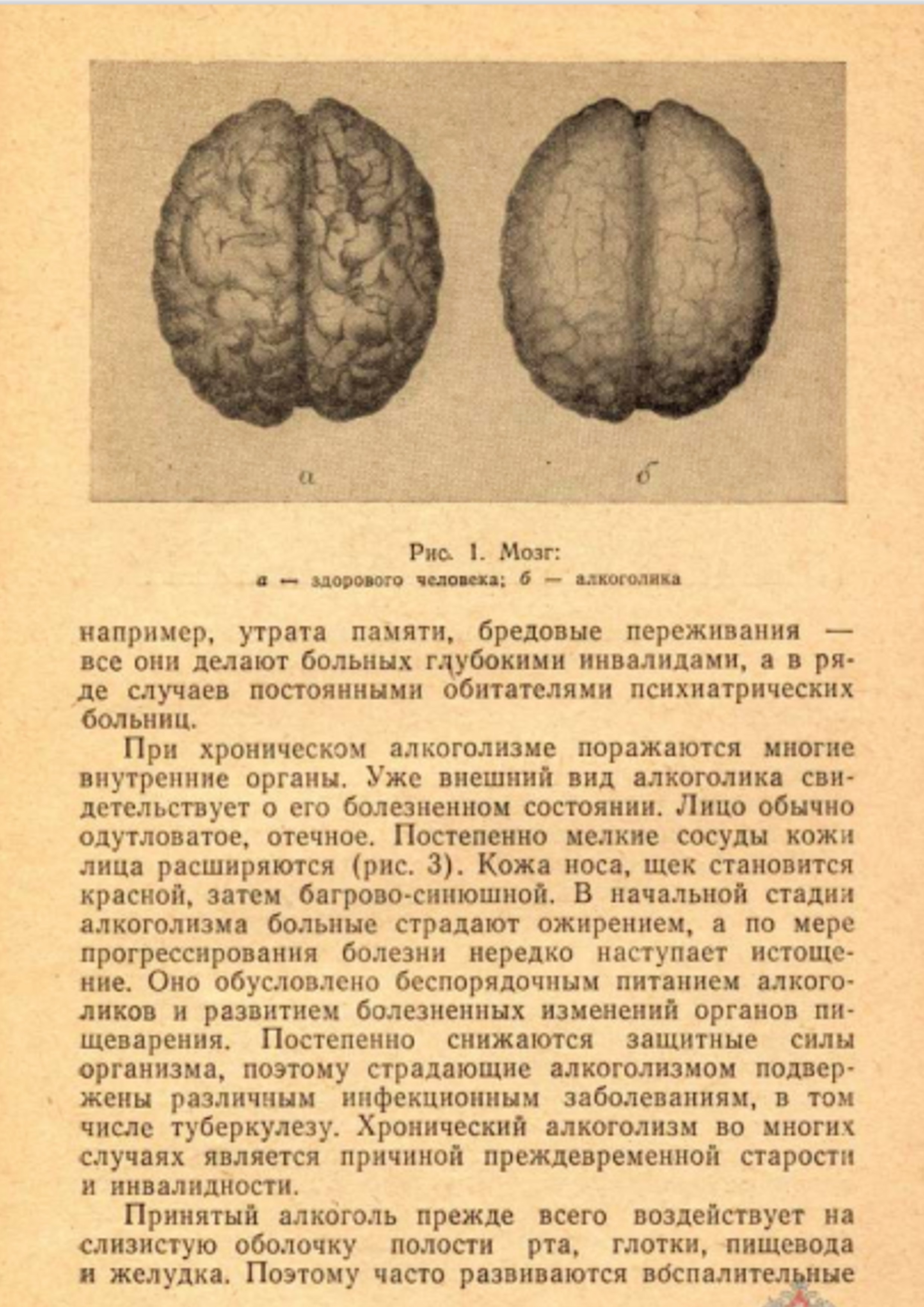 Вредное влияние алкоголя на здоровье, 1975 г.